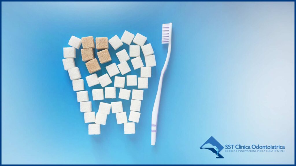 diabete e salute dentale
